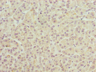 TMEM205 Antibody - Immunohistochemistry of paraffin-embedded human pancreatic tissue using TMEM205 Antibody at dilution of 1:100