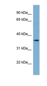 TMEM206 Antibody - TMEM206 / C1orf75 antibody Western blot of Fetal Stomach lysate. This image was taken for the unconjugated form of this product. Other forms have not been tested.