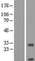 TMEM208 Protein - Western validation with an anti-DDK antibody * L: Control HEK293 lysate R: Over-expression lysate