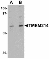TMEM214 / FLJ20254 Antibody - Western blot of TMEM214 in A20 cell lysate with TMEM214 antibody at (A) 1 and (B) 2 ug/ml. Below: Immunocytochemistry of TMEM214 in A20 cells with TMEM214 antibody at 5 ug/ml.