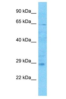 TMEM215 Antibody - TMEM215 antibody Western Blot of HCT15. Antibody dilution: 1 ug/ml.  This image was taken for the unconjugated form of this product. Other forms have not been tested.