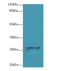 TMEM217 Antibody - Western blot. All lanes: TMEM217 antibody at 10 ug/ml+ Jurkat whole cell lysate Goat polyclonal to rabbit at 1:10000 dilution. Predicted band size: 27 kDa. Observed band size: 27 kDa.