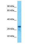 TMEM221 Antibody - TMEM221 antibody Western Blot of HCT15. Antibody dilution: 1 ug/ml.  This image was taken for the unconjugated form of this product. Other forms have not been tested.