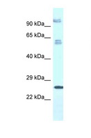 TMEM222 Antibody - C1orf160 / TMEM222 antibody Western blot of Fetal Lung lysate. Antibody concentration 1 ug/ml.  This image was taken for the unconjugated form of this product. Other forms have not been tested.