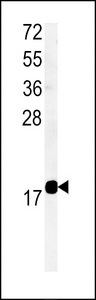 TMEM222 Antibody - Western blot of TM222 Antibody in mouse bladder tissue lysates (35 ug/lane). TM222 (arrow) was detected using the purified antibody.