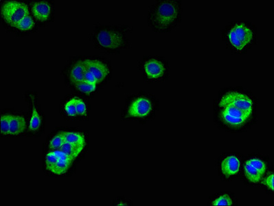TMEM222 Antibody - Immunofluorescent analysis of MCF-7 cells using TMEM222 Antibody at dilution of 1:100 and Alexa Fluor 488-congugated AffiniPure Goat Anti-Rabbit IgG(H+L)