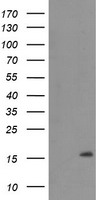 TMEM230 Antibody - HEK293T cells were transfected with the pCMV6-ENTRY control (Left lane) or pCMV6-ENTRY C20orf30 (Right lane) cDNA for 48 hrs and lysed. Equivalent amounts of cell lysates (5 ug per lane) were separated by SDS-PAGE and immunoblotted with anti-C20orf30.