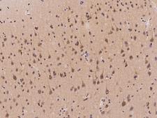 TMEM231 Antibody - Immunochemical staining of human TMEM231 in human brain with rabbit polyclonal antibody at 1:500 dilution, formalin-fixed paraffin embedded sections.