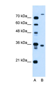 TMEM231 Antibody - TMEM231 / FLJ22167 antibody ARP45005_T100-NP_001070886-FLJ22167(hypothetical protein FLJ22167) Antibody Western blot of HepG2 cell lysate.  This image was taken for the unconjugated form of this product. Other forms have not been tested.