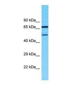 TMEM232 Antibody - Western blot of Human MDA-MB-435S. TMEM232 antibody dilution 1.0 ug/ml.  This image was taken for the unconjugated form of this product. Other forms have not been tested.