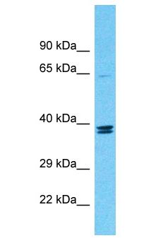 TMEM236 Antibody - TMEM236 antibody Western Blot of COLO205. Antibody dilution: 1 ug/ml.  This image was taken for the unconjugated form of this product. Other forms have not been tested.
