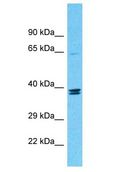 TMEM236 Antibody - TMEM236 antibody Western Blot of COLO205. Antibody dilution: 1 ug/ml.  This image was taken for the unconjugated form of this product. Other forms have not been tested.