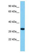 TMEM236 Antibody - TMEM236 antibody Western Blot of HepG2. Antibody dilution: 1 ug/ml.  This image was taken for the unconjugated form of this product. Other forms have not been tested.