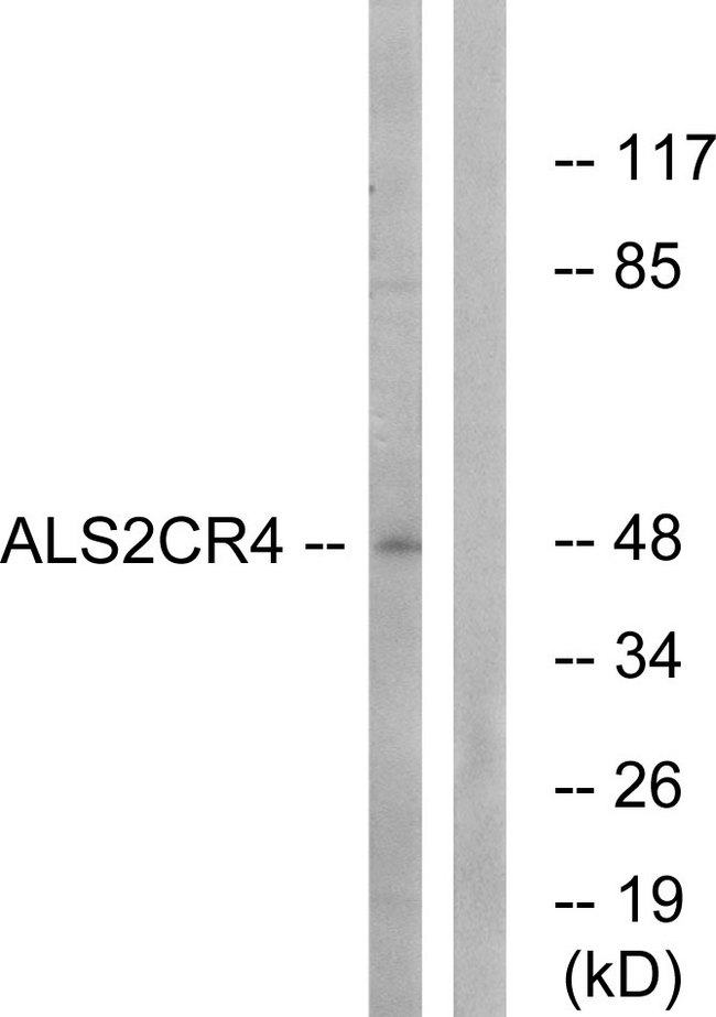 TMEM237 / ALS2CR4 Antibody - Western blot analysis of lysates from Jurkat cells, using ALS2CR4 Antibody. The lane on the right is blocked with the synthesized peptide.