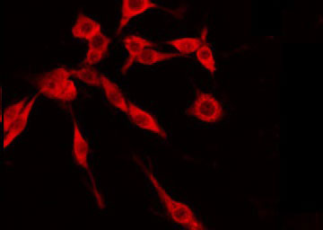 TMEM237 / ALS2CR4 Antibody - Staining HeLa cells by IF/ICC. The samples were fixed with PFA and permeabilized in 0.1% Triton X-100, then blocked in 10% serum for 45 min at 25°C. The primary antibody was diluted at 1:200 and incubated with the sample for 1 hour at 37°C. An Alexa Fluor 594 conjugated goat anti-rabbit IgG (H+L) Ab, diluted at 1/600, was used as the secondary antibody.