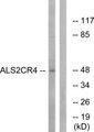 TMEM237 / ALS2CR4 Antibody - Western blot analysis of extracts from Jurkat cells, using ALS2CR4 antibody.