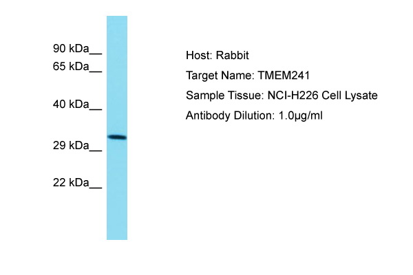 TMEM241 Antibody -  This image was taken for the unconjugated form of this product. Other forms have not been tested.