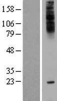 TMEM241 Protein - Western validation with an anti-DDK antibody * L: Control HEK293 lysate R: Over-expression lysate
