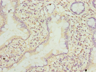 TMEM243 Antibody - Immunohistochemistry of paraffin-embedded human small intestine tissue using TMEM243 Antibody at dilution of 1:100