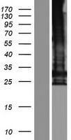 TMEM247 Protein - Western validation with an anti-DDK antibody * L: Control HEK293 lysate R: Over-expression lysate