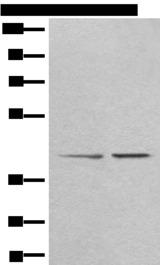 TMEM248 / c7orf42 Antibody - Western blot analysis of A172 and HEPG2 cell lysates  using TMEM248 Polyclonal Antibody at dilution of 1:300