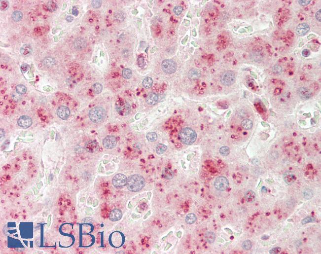 TMEM25 Antibody - Human Liver: Formalin-Fixed, Paraffin-Embedded (FFPE).  This image was taken for the unconjugated form of this product. Other forms have not been tested.