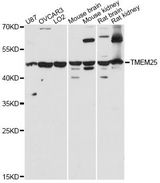 TMEM25 Antibody - Western blot analysis of extracts of various cell lines, using TMEM25 antibody at 1:3000 dilution. The secondary antibody used was an HRP Goat Anti-Rabbit IgG (H+L) at 1:10000 dilution. Lysates were loaded 25ug per lane and 3% nonfat dry milk in TBST was used for blocking. An ECL Kit was used for detection and the exposure time was 30s.