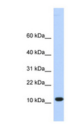 TMEM254 / C10orf57 Antibody - C10orf57 antibody Western blot of HeLa lysate. This image was taken for the unconjugated form of this product. Other forms have not been tested.