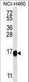 TMEM257 / CXorf1 Antibody - CX001 Antibody western blot of NCI-H460 cell line lysates (35 ug/lane). The CX001 antibody detected the CX001 protein (arrow).