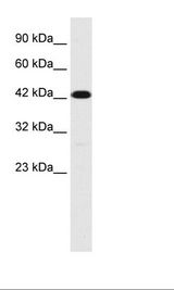 TMEM259 / Membralin Antibody - Jurkat Cell Lysate.  This image was taken for the unconjugated form of this product. Other forms have not been tested.