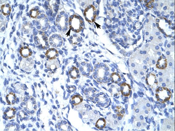 TMEM259 / Membralin Antibody - C19orf6 / Membralin antibody ARP34137_T100-NP_219488-C19ORF6 Antibody was used in IHC to stain formalin-fixed, paraffin-embedded human kidney.  This image was taken for the unconjugated form of this product. Other forms have not been tested.