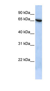 TMEM259 / Membralin Antibody - C19orf6 / Membralin antibody Western blot of HepG2 cell lysate. This image was taken for the unconjugated form of this product. Other forms have not been tested.