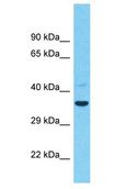 TMEM26 Antibody - TMEM26 antibody Western Blot of COLO205. Antibody dilution: 1 ug/ml.  This image was taken for the unconjugated form of this product. Other forms have not been tested.
