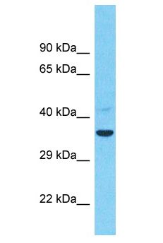 TMEM26 Antibody - TMEM26 antibody Western Blot of COLO205. Antibody dilution: 1 ug/ml.  This image was taken for the unconjugated form of this product. Other forms have not been tested.