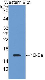 TMEM27 / Collectrin Antibody - Western blot of TMEM27 / Collectrin antibody.