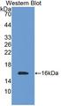 TMEM27 / Collectrin Antibody - Western blot of TMEM27 / Collectrin antibody.