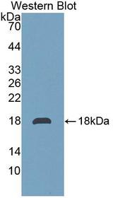 TMEM27 / Collectrin Antibody - Western blot of TMEM27 / Collectrin antibody.