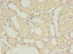 TMEM27 / Collectrin Antibody - Immunohistochemistry of paraffin-embedded human kidney using antibody at 1:100 dilution.  This image was taken for the unconjugated form of this product. Other forms have not been tested.