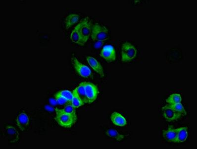 TMEM27 / Collectrin Antibody - Immunofluorescent analysis of MCF-7 cells using TMEM27 Antibody at dilution of 1:100 and Alexa Fluor 488-congugated AffiniPure Goat Anti-Rabbit IgG(H+L)