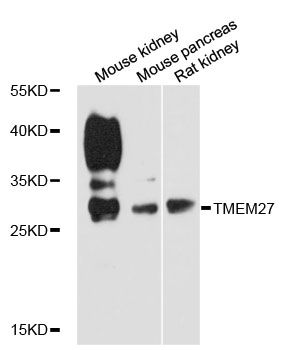 TMEM27 / Collectrin Antibody - Western blot analysis of extracts of various cell lines, using TMEM27 antibody at 1:3000 dilution. The secondary antibody used was an HRP Goat Anti-Rabbit IgG (H+L) at 1:10000 dilution. Lysates were loaded 25ug per lane and 3% nonfat dry milk in TBST was used for blocking. An ECL Kit was used for detection and the exposure time was 90s.
