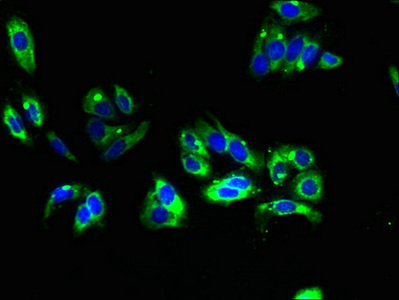 TMEM31 Antibody - Immunofluorescent analysis of HepG2 cells using TMEM31 Antibody at dilution of 1:100 and Alexa Fluor 488-congugated AffiniPure Goat Anti-Rabbit IgG(H+L)