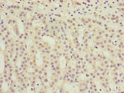 TMEM31 Antibody - Immunohistochemistry of paraffin-embedded human adrenal gland tissue using TMEM31 Antibody at dilution of 1:100