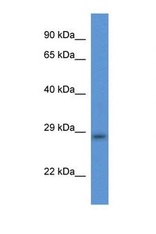 TMEM33 Antibody - TMEM33 antibody Western blot of Rat Heart lysate. Antibody concentration 1 ug/ml. This image was taken for the unconjugated form of this product. Other forms have not been tested.