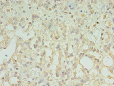 TMEM33 Antibody - Immunohistochemistry of paraffin-embedded human adrenal gland tissue using antibody at dilution of 1:100.