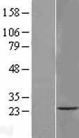 TMEM33 Protein - Western validation with an anti-DDK antibody * L: Control HEK293 lysate R: Over-expression lysate