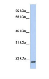 TMEM35 Antibody - Fetal brain lysate. Antibody concentration: 1.0 ug/ml. Gel concentration: 12%.  This image was taken for the unconjugated form of this product. Other forms have not been tested.