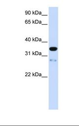 TMEM38A Antibody - Fetal muscle lysate. Antibody concentration: 1.0 ug/ml. Gel concentration: 12%.  This image was taken for the unconjugated form of this product. Other forms have not been tested.