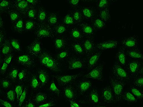 TMEM38A Antibody - Immunofluorescence staining of TMEM38A in U2OS cells. Cells were fixed with 4% PFA, permeabilzed with 0.1% Triton X-100 in PBS, blocked with 10% serum, and incubated with rabbit anti-Human TMEM38A polyclonal antibody (dilution ratio 1:200) at 4°C overnight. Then cells were stained with the Alexa Fluor 488-conjugated Goat Anti-rabbit IgG secondary antibody (green). Positive staining was localized to Nucleus.