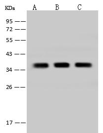 TMEM38A Antibody - Anti-TMEM38A rabbit polyclonal antibody at 1:5000 dilution. Lane A: Jurkat Whole Cell Lysate. Lane B: HeLa Whole Cell Lysate. Lane C: U-251 MG Whole Cell Lysate. Lysates/proteins at 30 ug per lane. Secondary: Goat Anti-Rabbit IgG (H+L)/HRP at 1/10000 dilution. Developed using the ECL technique. Performed under reducing conditions. Predicted band size: 33 kDa. Observed band size: 36 kDa.