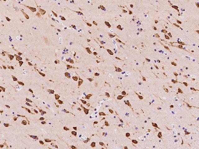 TMEM38A Antibody - Immunochemical staining of human TMEM38A in human brain with rabbit polyclonal antibody at 1:100 dilution, formalin-fixed paraffin embedded sections.